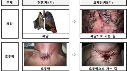 "성기능 장애로 가는 길"…담뱃갑 그림·문구 더 살벌하게 바뀐다