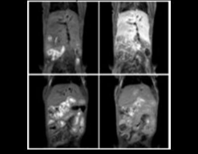 팜젠사이언스, 세계 최초 거대고리형 MRI 간특이 조영제 신약 일본 특허 등록