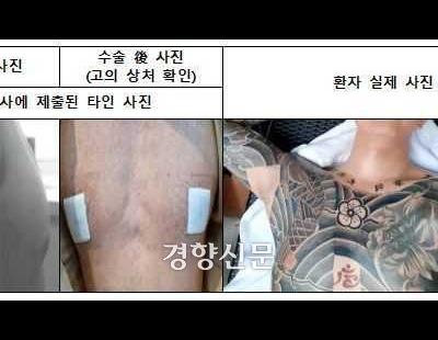 여유증·다한증 수술한다 속여 12억원 챙긴 조폭·병원 관계자 덜미