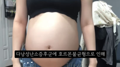 "의사가 임신 몰랐다?" 만삭 낙태 영상, 주작으로 지목된 증거들