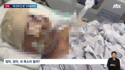 "연락 안 받아?" 남친 폭행에…남매 키우던 '싱글맘' 의식불명