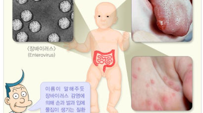 수족구병 환자 두달새 8배…영유아 중심 확산, '손씻기' 챙겨야