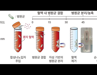 한시가 급한 패혈증 치료··· 최단시간에 최적 항균제 찾는 검사법 나왔다