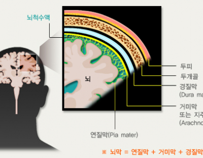 물놀이 다녀온 뒤 심한 감기 기운? 어쩌면…뇌수막염일 수도