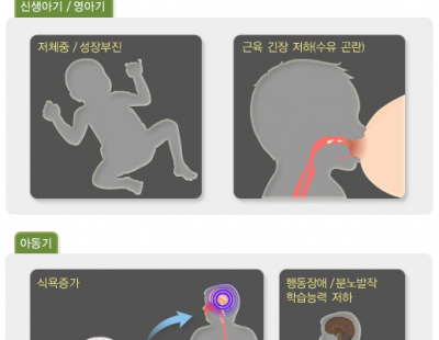 과한 식욕 참지 못하는 아이··· ‘이 질환’ 있다면 조기에 치료해야