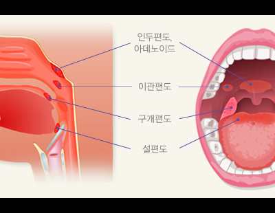 쓸모 없다 생각해 잘라냈던 ‘편도·아데노이드’··· 감염 막는 면역기능 좌우