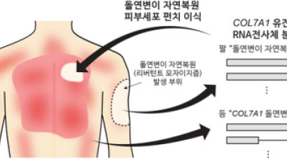 '약한 마찰에도 상처·수포' 희귀 피부질환, 국내서 치료법 찾아